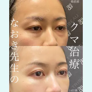 EMMO FACE CLINIC 大宮院 廣松 直樹医師の症例