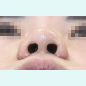 聖心美容クリニック 福岡院 美原 寿之医師の症例