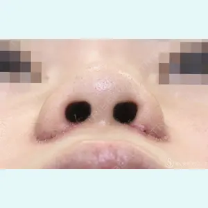 聖心美容クリニック 福岡院 美原 寿之医師の症例