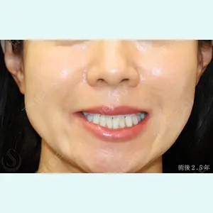 聖心美容クリニック 銀座院 牧野 陽二郎医師の症例