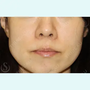 聖心美容クリニック 銀座院 牧野 陽二郎医師の症例