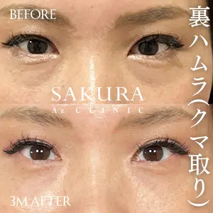 サクラアズクリニック 心斎橋院 佐藤 博文医師の症例