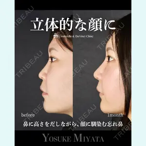 シンデレラ＆ダヴィンチクリニック 宮田 洋佑医師の症例