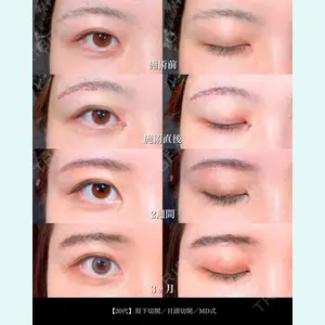 東京シンデレラ美容外科 大宮院 竹田 昌平医師の症例