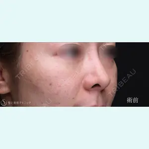 聖心美容クリニック 銀座院 川端 優也医師の症例