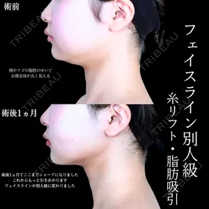 アリエル美容クリニック 水戸院 天白 典秀医師の症例