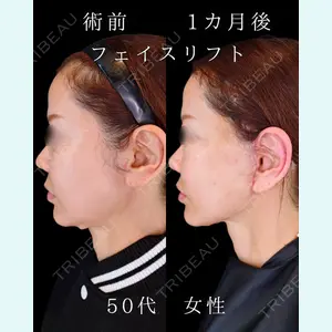 HAAB BEAUTY CLINIC 南青山本院（新院） 小平 佳典医師の症例