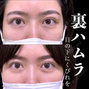 EMMO FACE CLINIC 大宮院 百瀬 直也医師の症例
