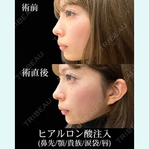 HAAB×DREAM BEAUTY CLINIC 東京本院 佐野 圭医師の症例