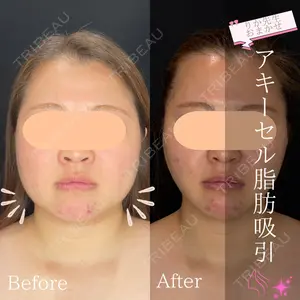 渋谷あおぞらクリニック美容外科・美容皮膚科 川口 理夏医師の症例