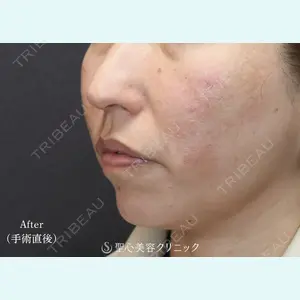 聖心美容クリニック 大阪院 大井 弘一医師の症例