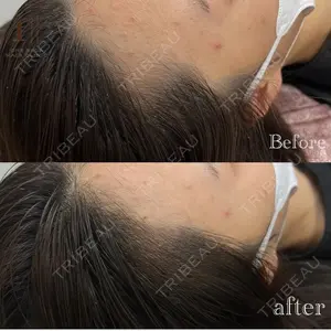 ワンストップヘアクリニック 大阪院 吉田医師の症例