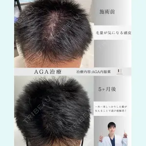 ワンストップヘアクリニック 大阪院 河合 駿医師の症例