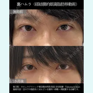 ネビュラクリニック 東京錦糸町院 岩切 琢磨医師の症例