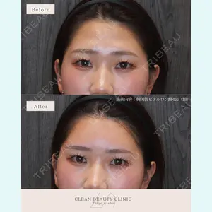 CLEAN BEAUTY CLINIC TokyoAzabu 三田 亜耶医師の症例