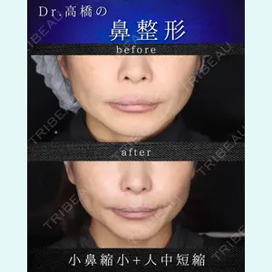 吉祥寺アイビークリニック 高橋 京佑 医師の症例