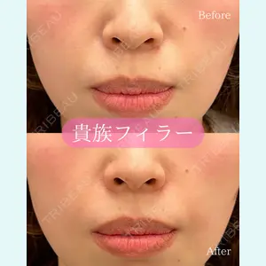 ルラ美容クリニック 郡山院の症例