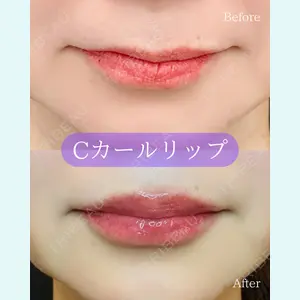 ルラ美容クリニック 郡山院の症例