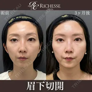 銀座リシェスクリニック 平岡 美樹子医師の症例