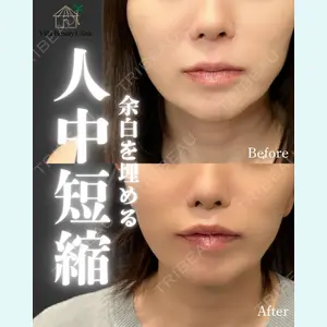 小倉美容外科/美容皮膚科 ビラビューティークリニック 大村 亞蘭医師の症例