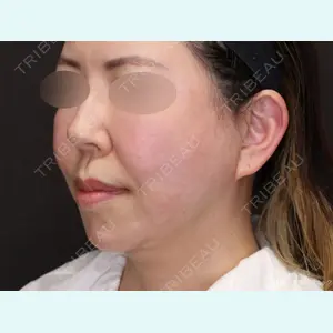 聖心美容クリニック 大阪院 寺町 英明医師の症例