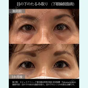 ネビュラクリニック 東京錦糸町院 岩切 琢磨医師の症例