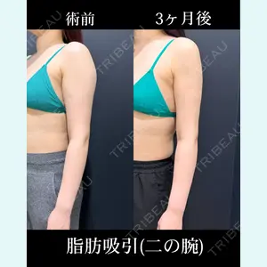 HAAB×DREAM BEAUTY CLINIC 東京本院 吉岡 修一医師の症例