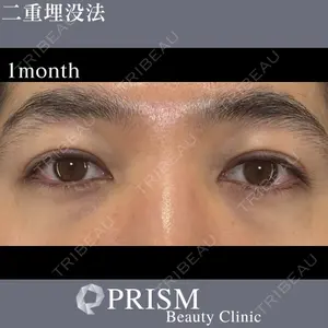 PRISM Beauty Clinic 新宿院の症例