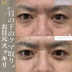 症例