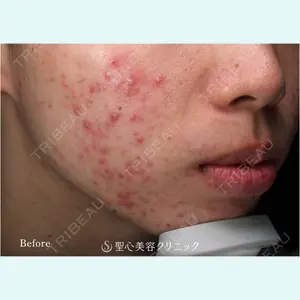 聖心美容クリニック 大阪院 大井 弘一医師の症例