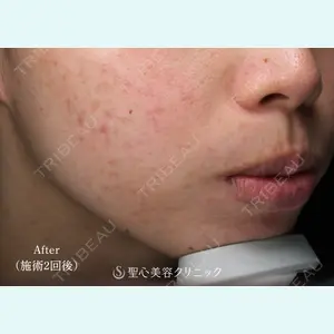 聖心美容クリニック 大阪院 大井 弘一医師の症例