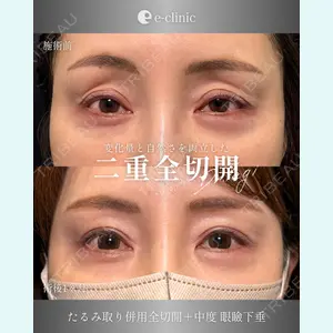 eクリニック 大阪院 八木 良太医師の症例