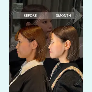 HAAB BEAUTY CLINIC 南青山本院（新院） 金子 雄医師の症例