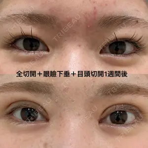 エターナル美容クリニック 久門田 詳医師の症例