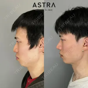 ASTRA BEAUTY CLINIC 塩満 惠子医師の症例