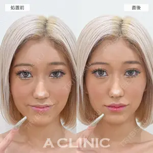 A CLINIC（エークリニック） 銀座院 新妻　克宜医師の症例