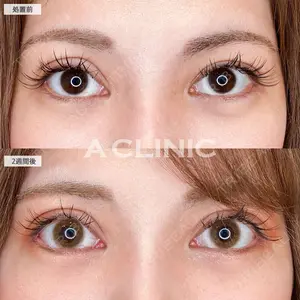 A CLINIC（エークリニック） 大阪院 田窪 賢志郎医師の症例