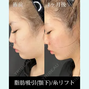 HAAB×DREAM BEAUTY CLINIC 大阪梅田院 柏木 太雅医師の症例