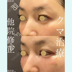 EMMO FACE CLINIC 大宮院 廣松 直樹医師の症例