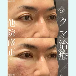 EMMO FACE CLINIC 大宮院 廣松 直樹医師の症例