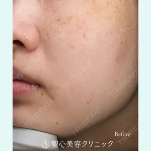 聖心美容クリニック 大阪院 大井 弘一医師の症例