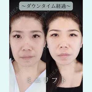 HAAB BEAUTY CLINIC 南青山本院（新院） 小平 佳典医師の症例