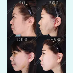 HAAB BEAUTY CLINIC 南青山本院（新院） 小平 佳典医師の症例