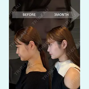 HAAB BEAUTY CLINIC 南青山本院（新院） 金子 雄医師の症例