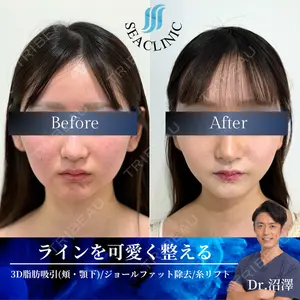 SEA CLINIC（シークリニック） 沼澤 茂医師の症例