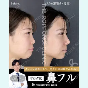 THE ROPPONGI CLINIC（ザ 六本木クリニック） 石黒 昂医師の症例