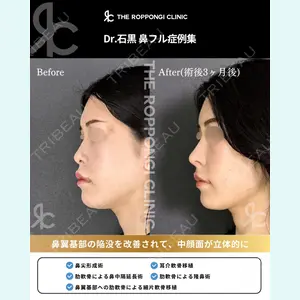 THE ROPPONGI CLINIC（ザ 六本木クリニック） 石黒 昂医師の症例