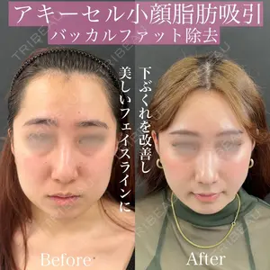 ルラ美容クリニック 渋谷本院 昼間 路子医師の症例