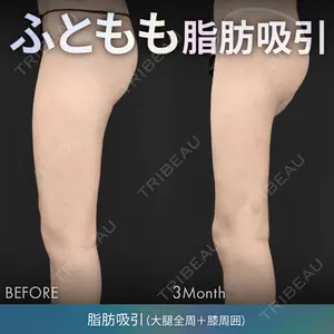 ジョウクリニック 銀座院 重本　譲医師の症例