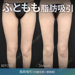 ジョウクリニック 銀座院 重本　譲医師の症例